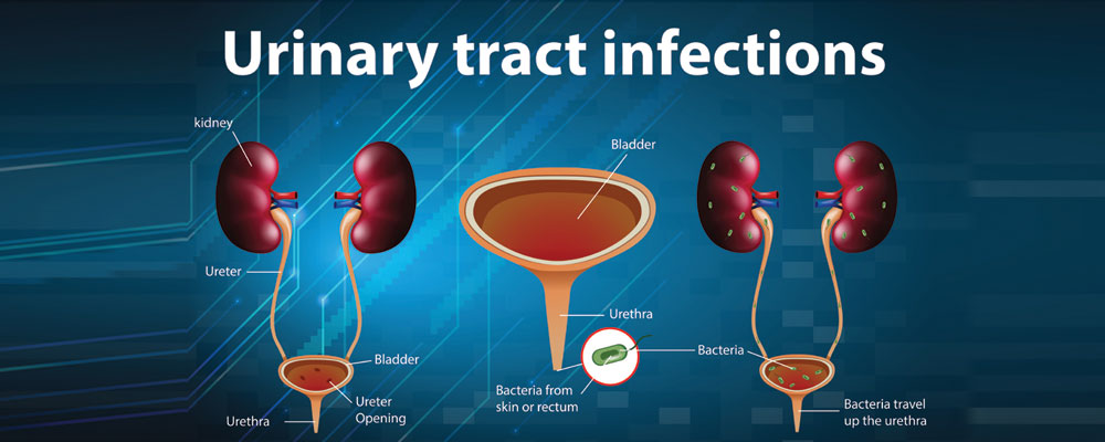 Urologist_Vanaja_Hospital